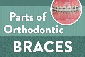 Parts of Orthodontic Braces