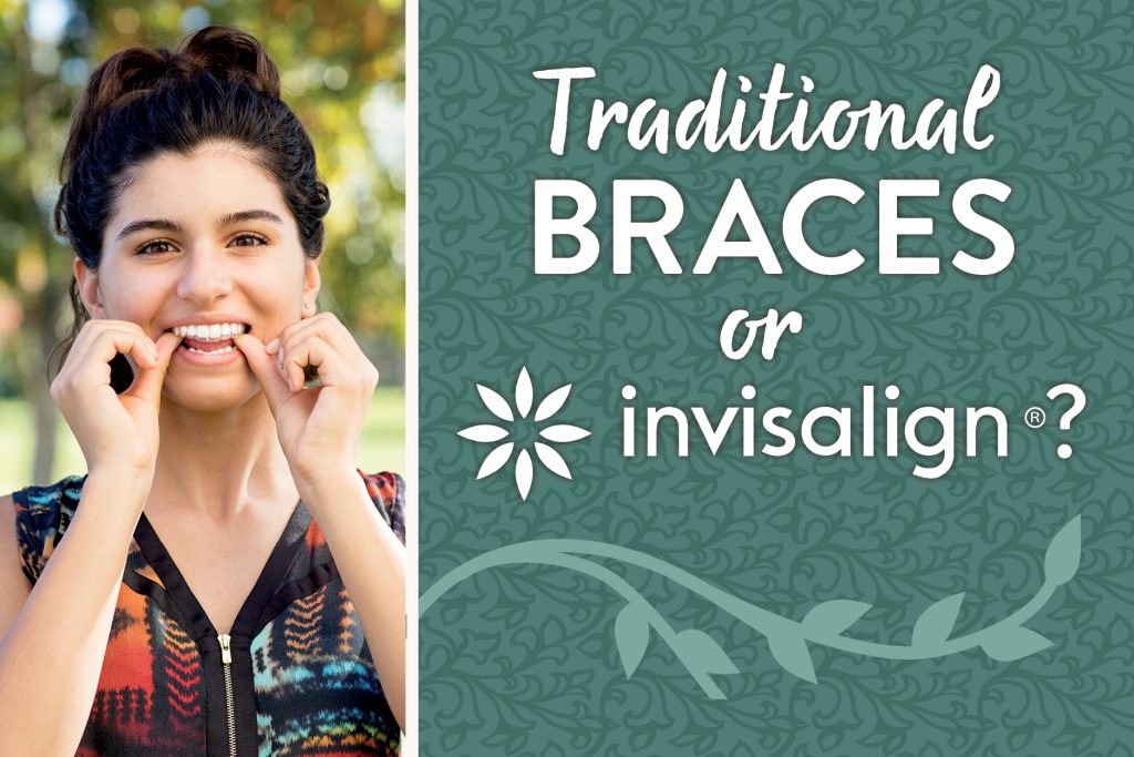 traditional braces