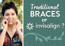 traditional braces