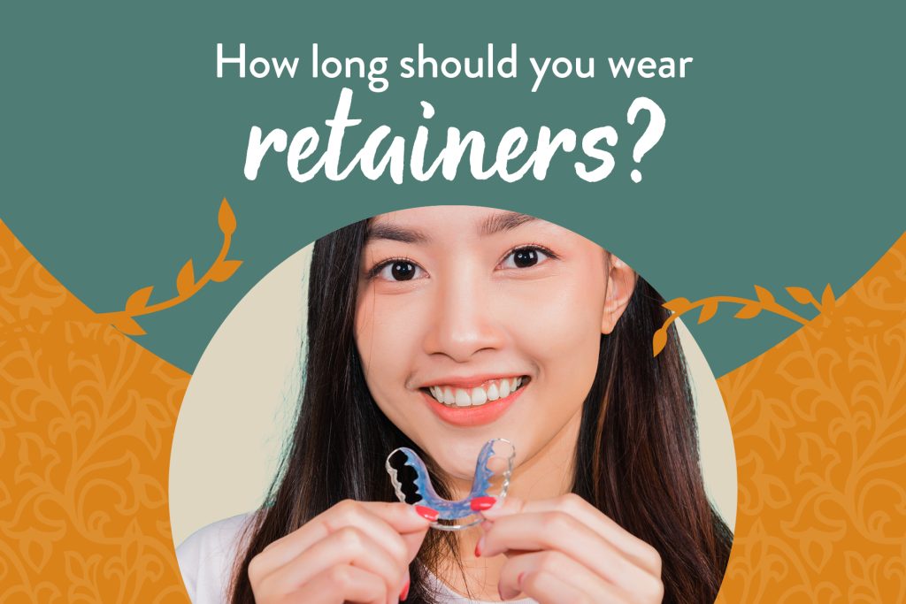 how long to wear retainers